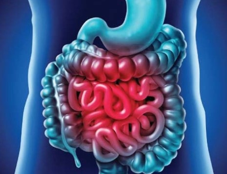 Incomplete Absorption illustration